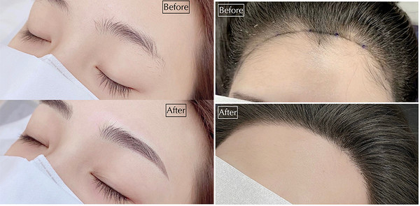 LA에서 13년째 반영구 문신 시술을 해오고 있는 '레베카 뷰티 반영구 문신'의 신 대표는 정기적으로 덴버를 방문해 눈썹, 아이라이너, 헤어라인, 립라인 등 시술을 하고 있다.